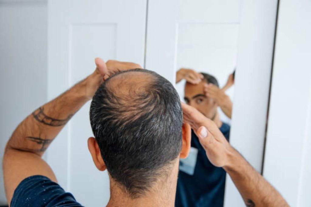 hats and hair loss